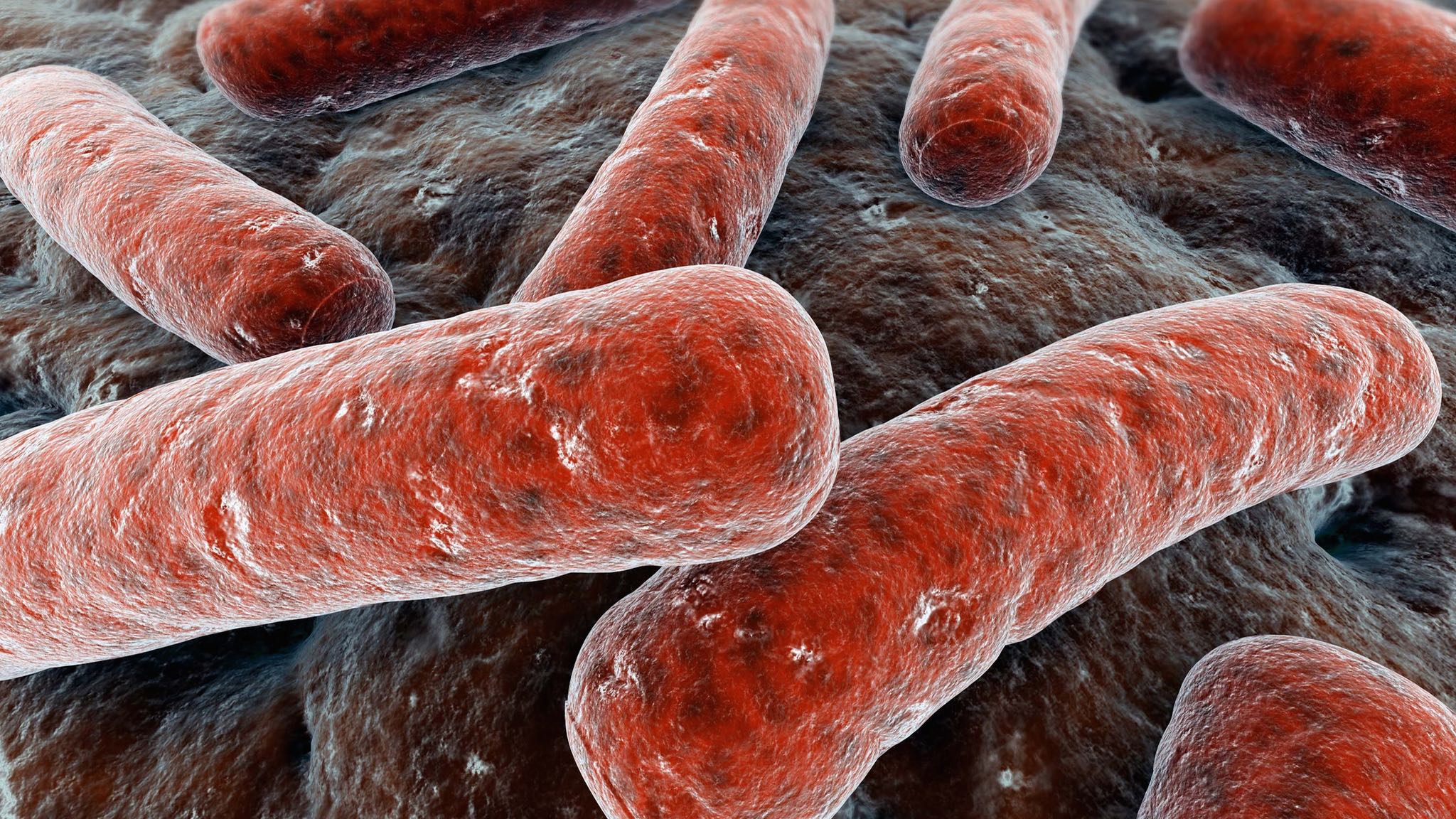 tuberculosis