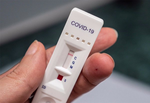 Rapid antigen test