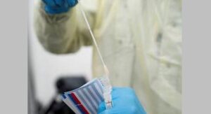 RT-PCR