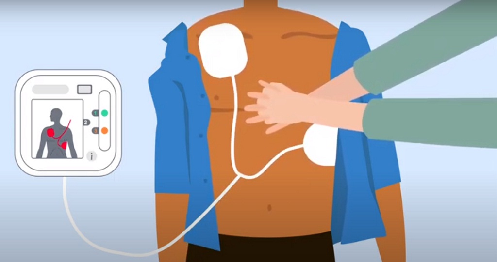 defibrillator