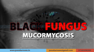 Black Fungus Mucormycosis