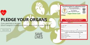 Pledge Organ Donation