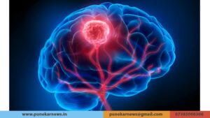 Brain Tumor