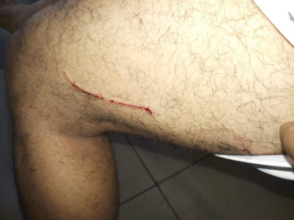 leopard attack in Pune