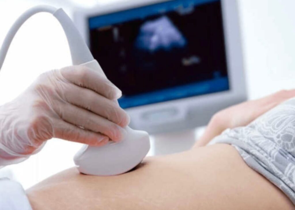 Sonography