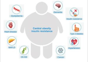Health Disease