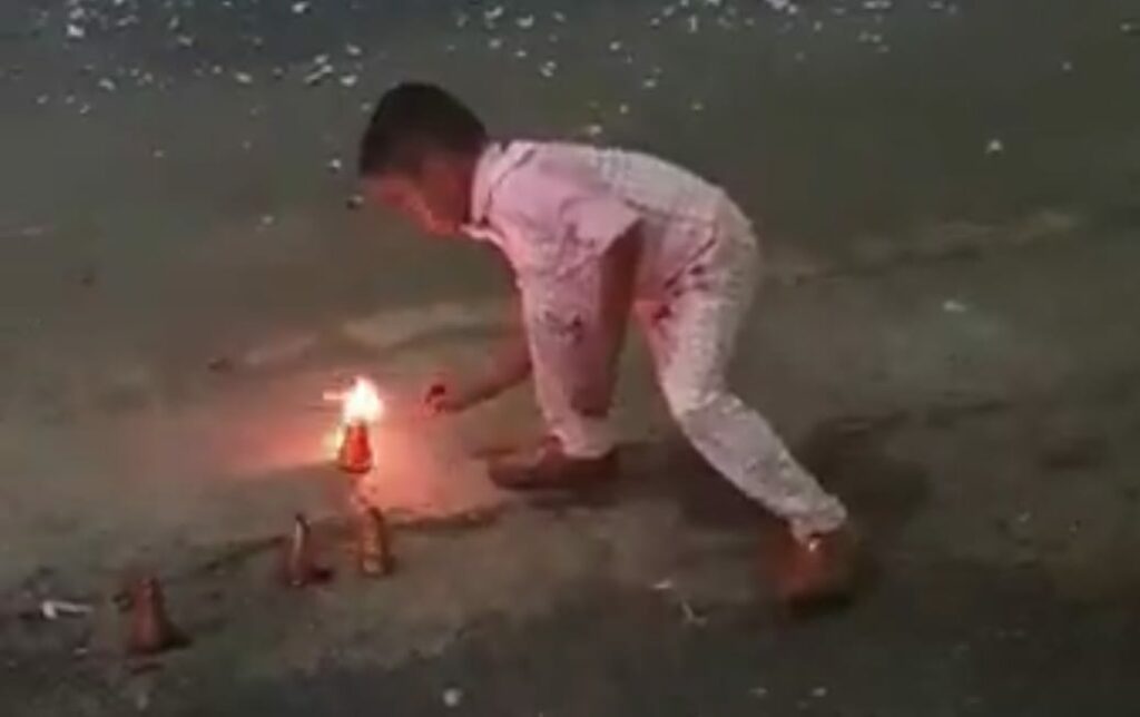 Child Injured