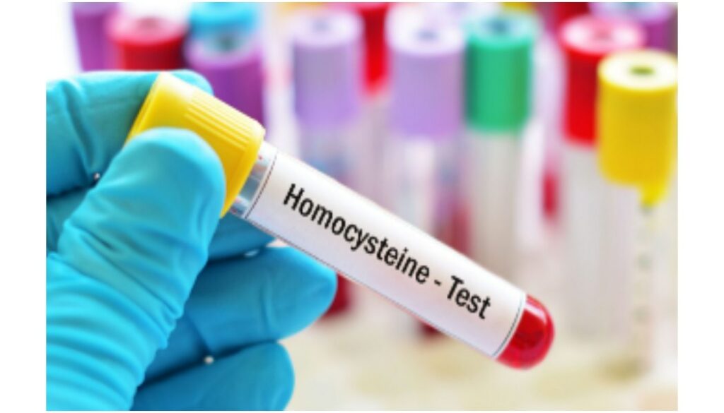 homocysteine