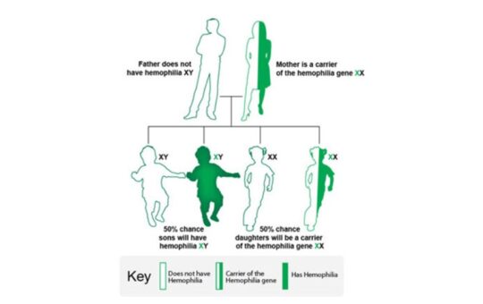 Haemophilia