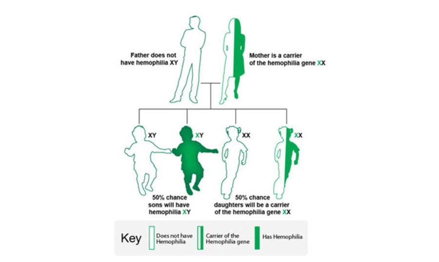 Haemophilia