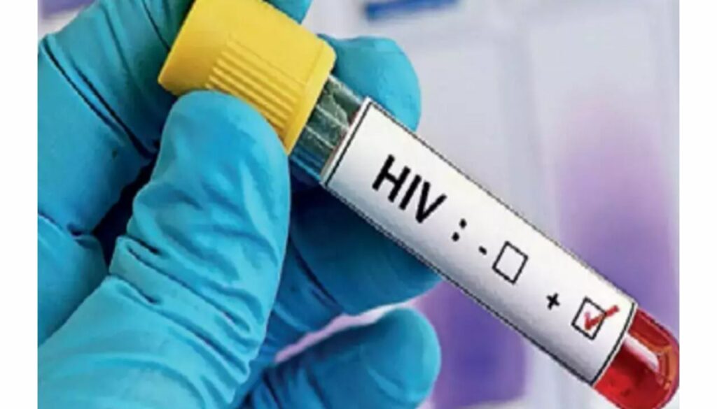 HIV (1)