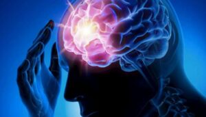 Epilepsy