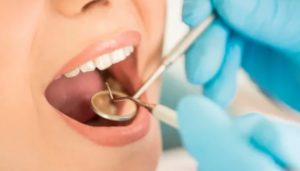 Dental Check-Ups
