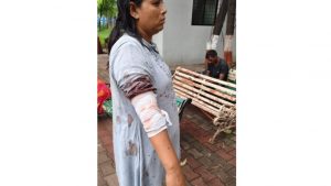 Injured Woman
