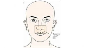 Risks of Acne