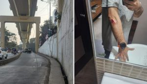 Cyclist Injured by Dangling Wire at Ramwadi Underpass
