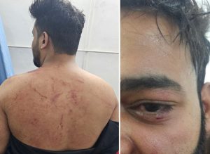 Saswad assault case