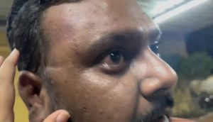 Couple and 3-Year-Old Child Assaulted in Wagholi After Traffic Dispute