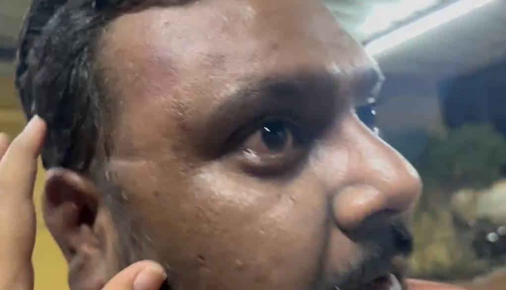 Couple and 3-Year-Old Child Assaulted in Wagholi After Traffic Dispute