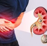 Drinking Too Little Water Can Lead to Serious Health Problems