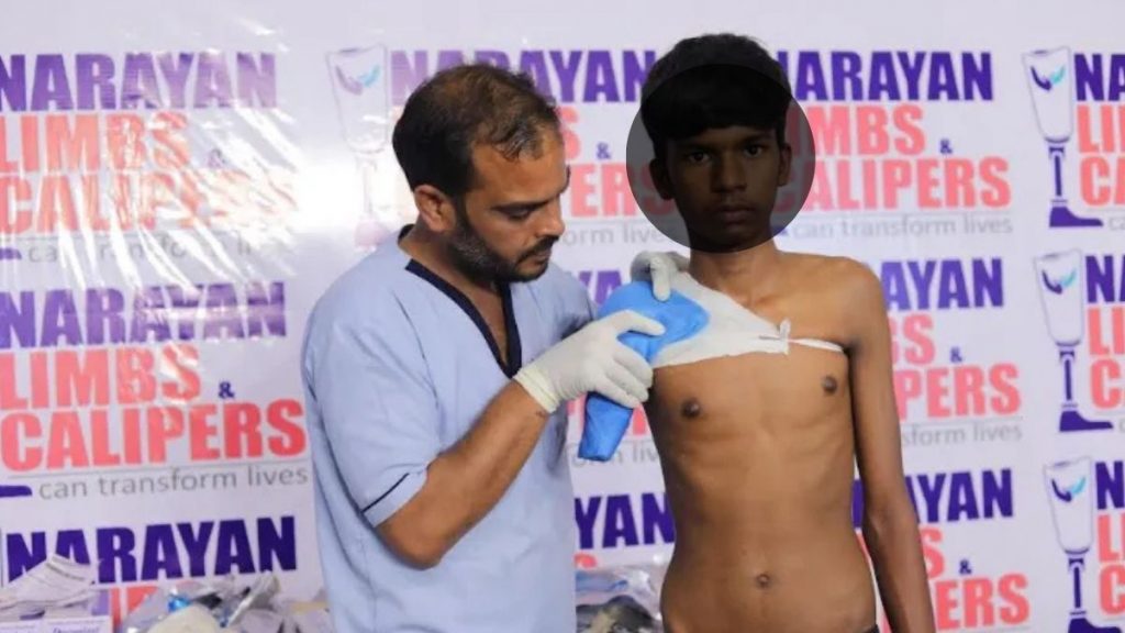 Japanese German Technology-Based Narayan Modular Artificial Limb Fitment Camp