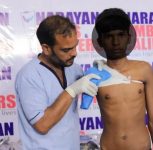 Japanese German Technology-Based Narayan Modular Artificial Limb Fitment Camp to be Held in Pune on August 23