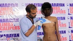 Japanese German Technology-Based Narayan Modular Artificial Limb Fitment Camp