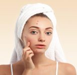 How to Choose the Right Sunscreen for Oily and Acne-Prone Skin