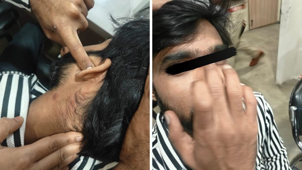 Three Booked After Man Assaulted Over Argument in Bavdhan
