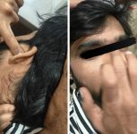 Pune: Three Booked After Man Assaulted Over Argument in Bavdhan, Laptop and Glasses Damaged